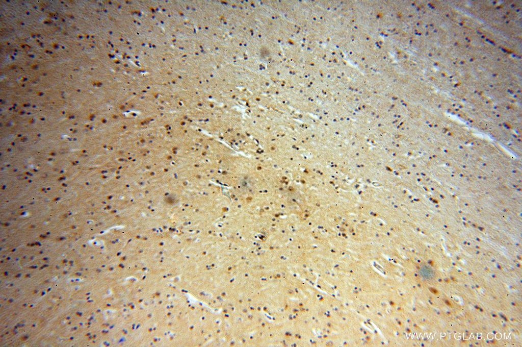 IHC staining of human brain using 17743-1-AP