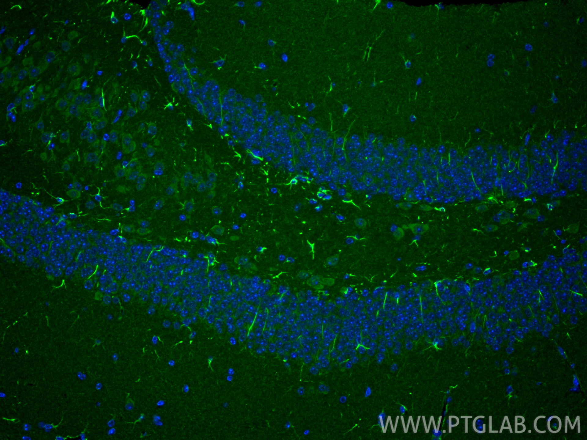 IF Staining of mouse brain using 26295-1-AP IF Staining of mouse brain using 26295-1-AP