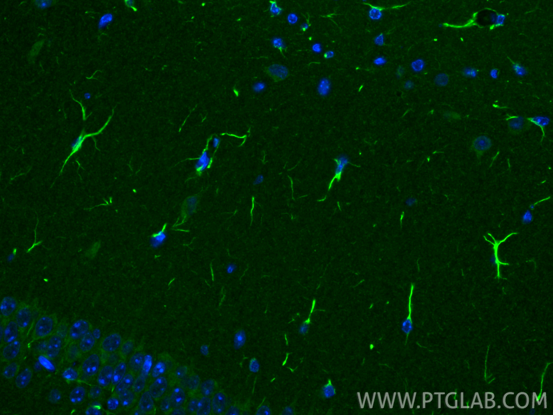 IF Staining of mouse brain using 26295-1-AP IF Staining of mouse brain using 26295-1-AP