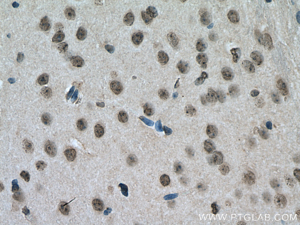 IHC staining of mouse brain using 14392-1-AP