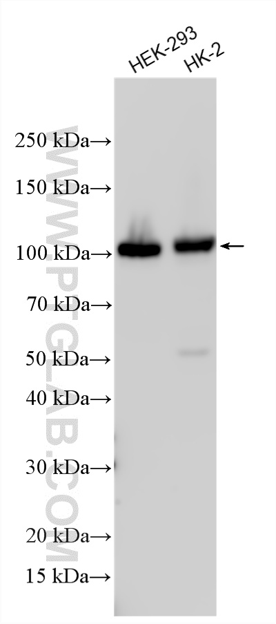 WB analysis using 14392-1-AP