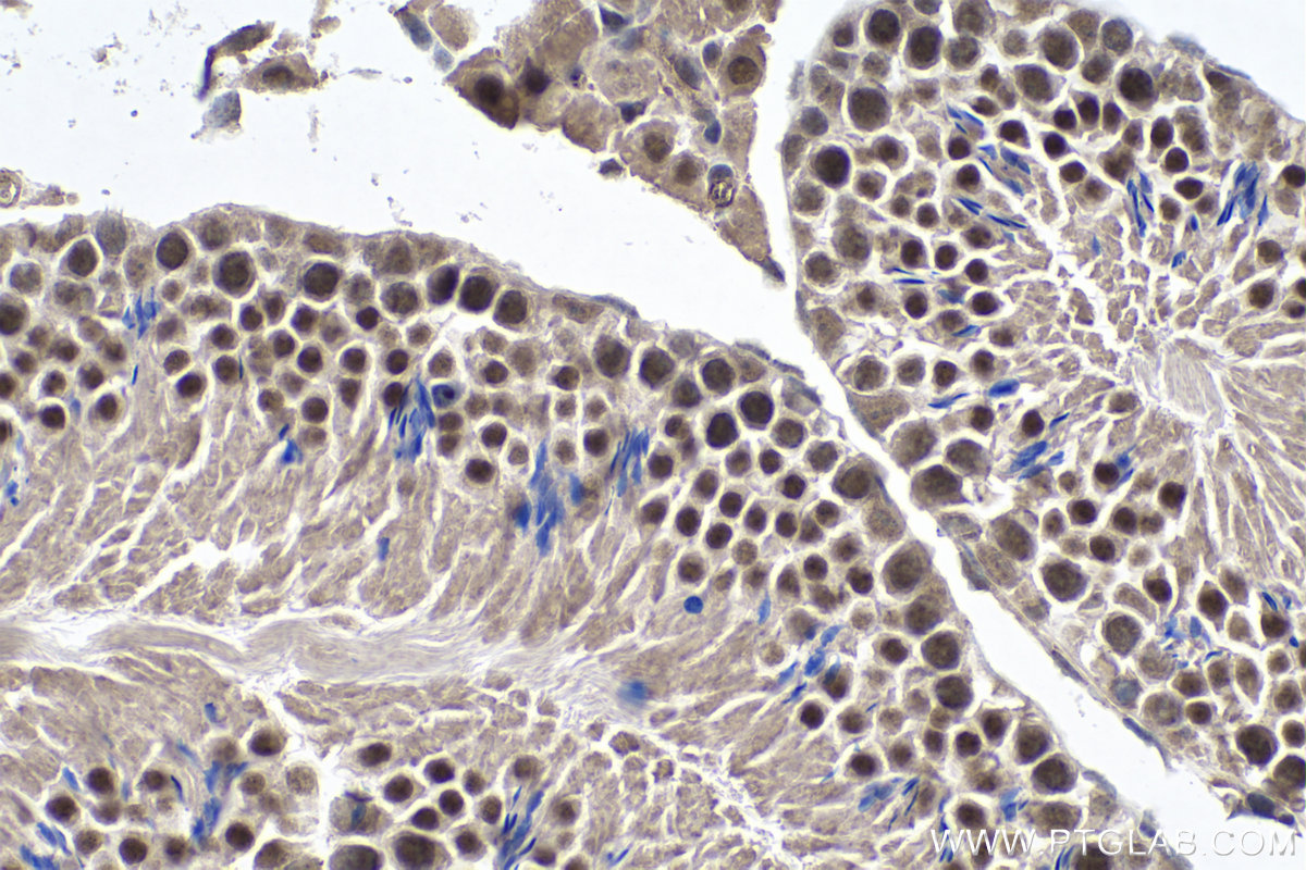 IHC staining of mouse testis using 67911-1-Ig