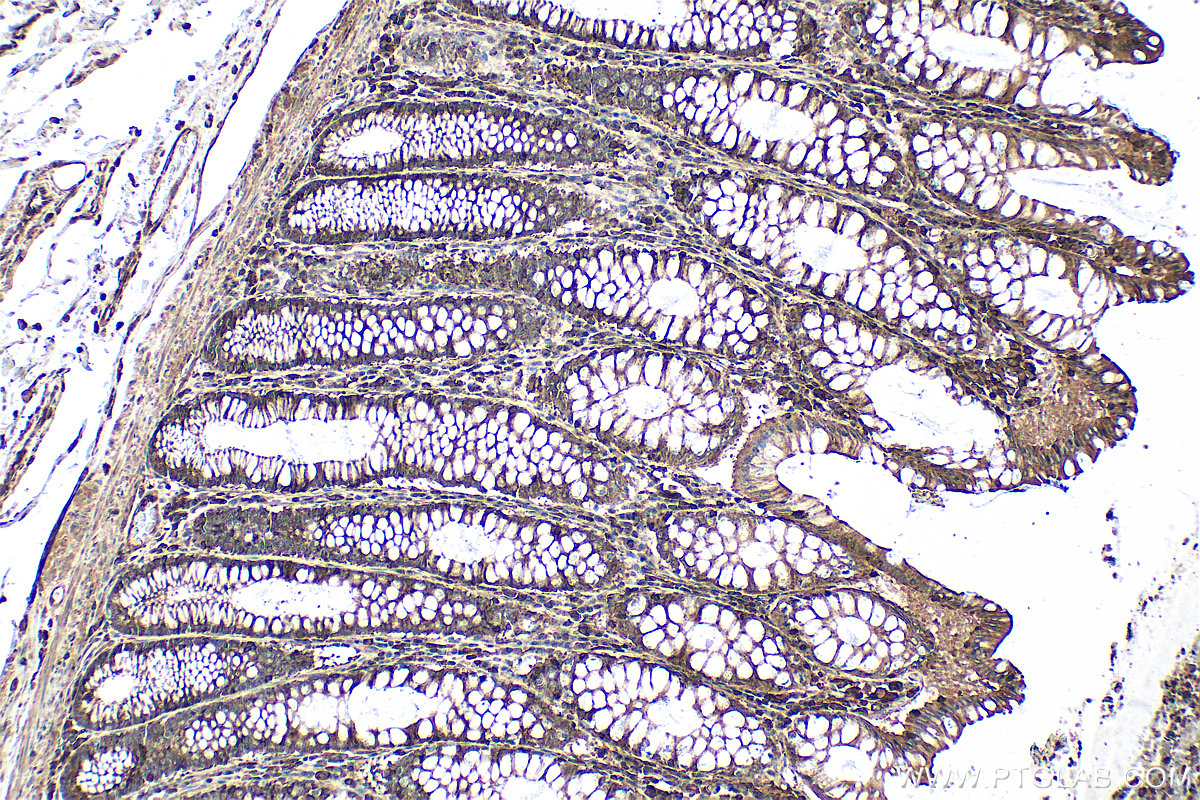 IHC staining of human colon using 27779-1-AP