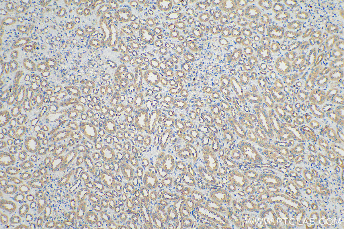 IHC staining of human kidney using 17479-1-AP