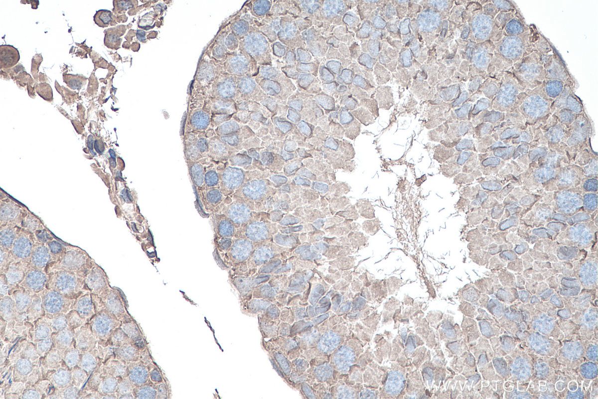 IHC staining of rat testis using 66745-1-Ig (same clone as 66745-1-PBS)