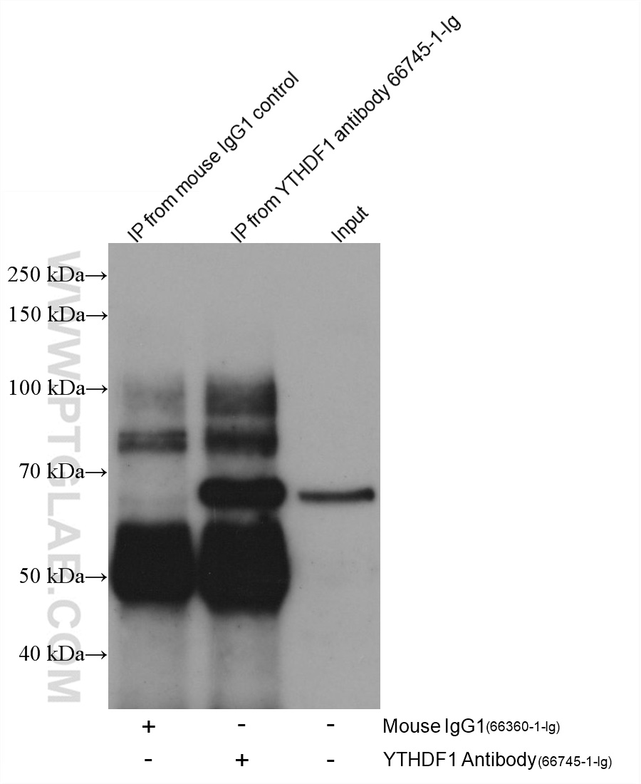 IP experiment of Jurkat using 66745-1-Ig