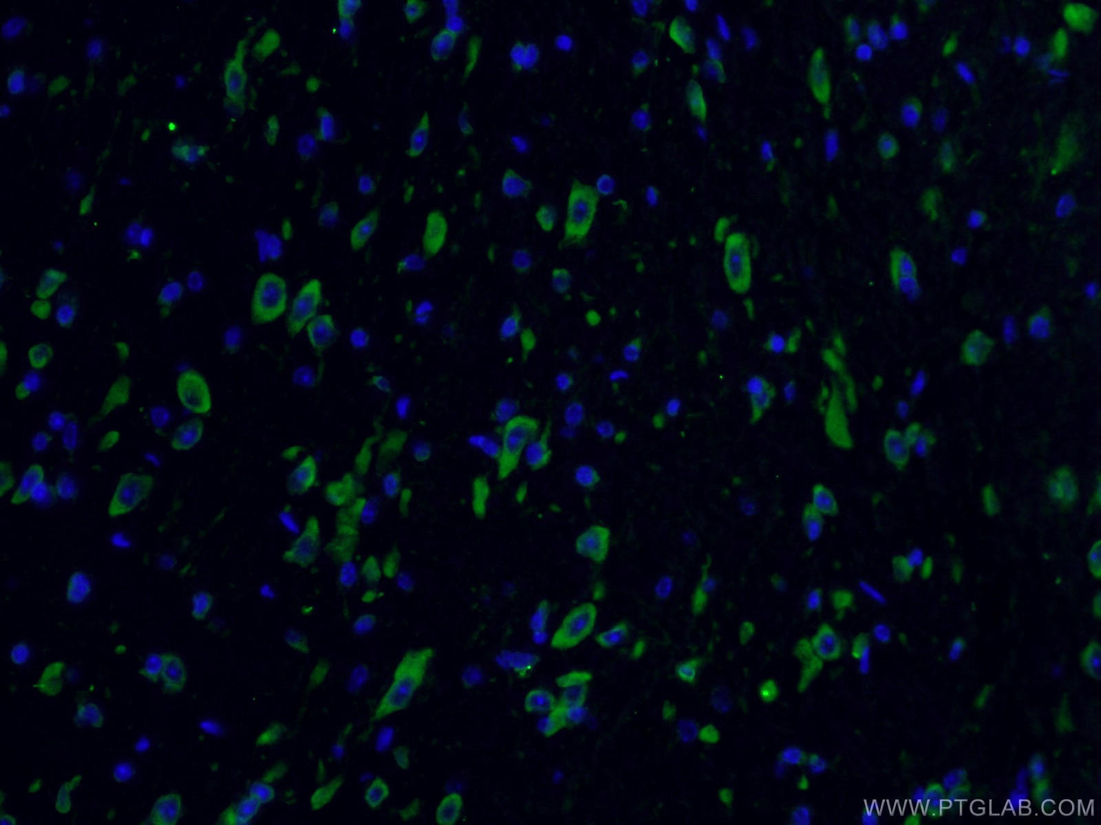IF Staining of mouse brain using 24744-1-AP