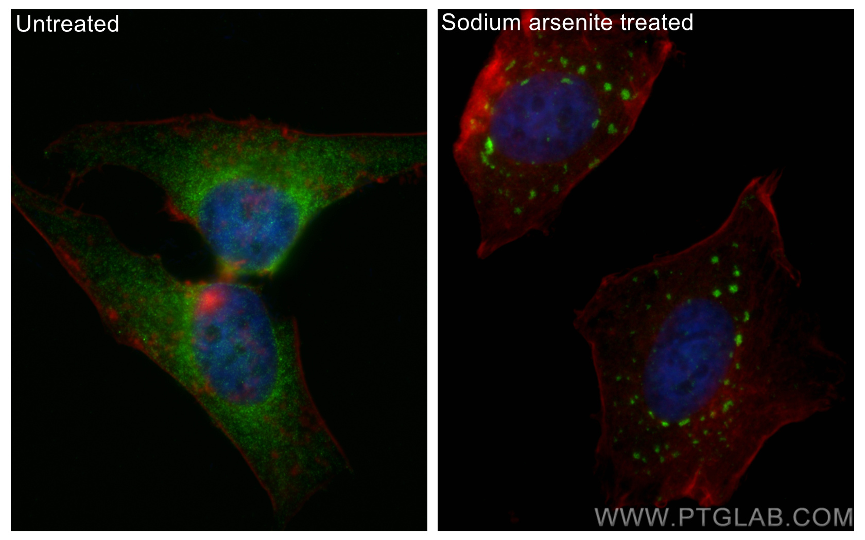 IF Staining of HeLa using 81340-1-RR (same clone as 81340-1-PBS)