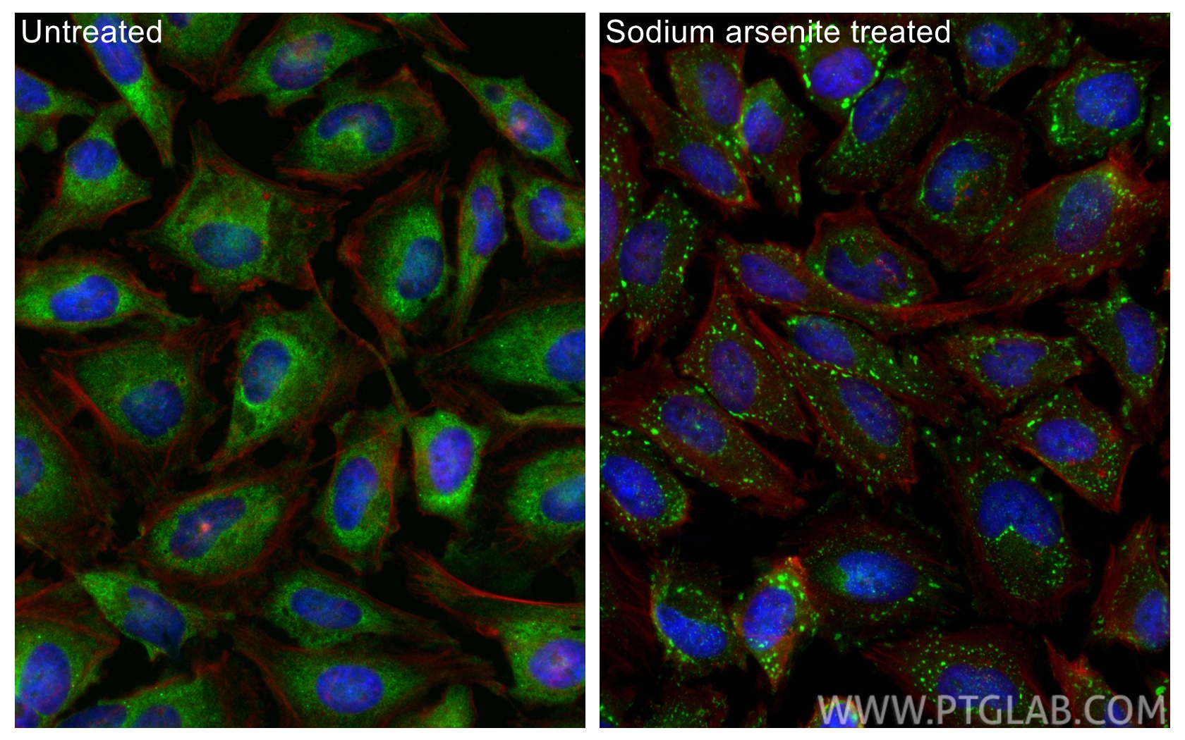IF Staining of HeLa using 81340-1-RR (same clone as 81340-1-PBS)
