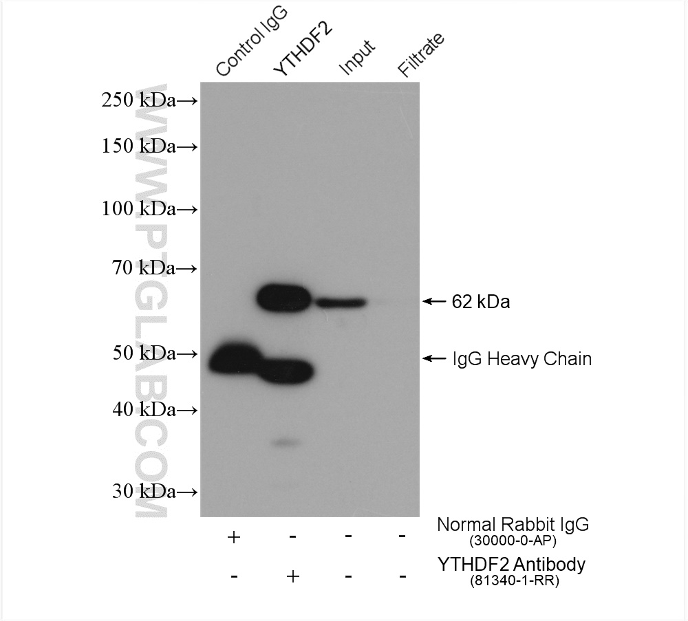 IP experiment of HeLa using 81340-1-RR (same clone as 81340-1-PBS)