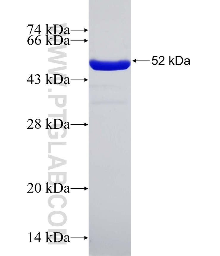 YTHDF2 fusion protein Ag0376 SDS-PAGE