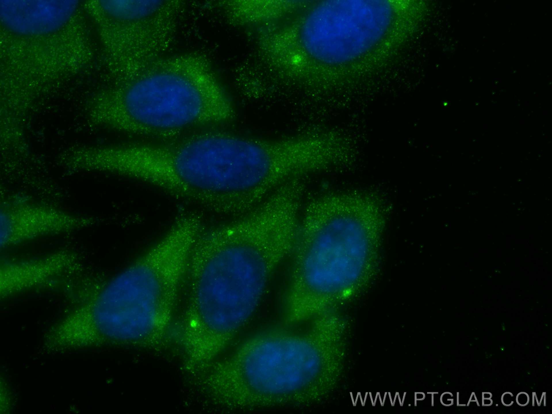 IF Staining of HepG2 using 10936-1-AP