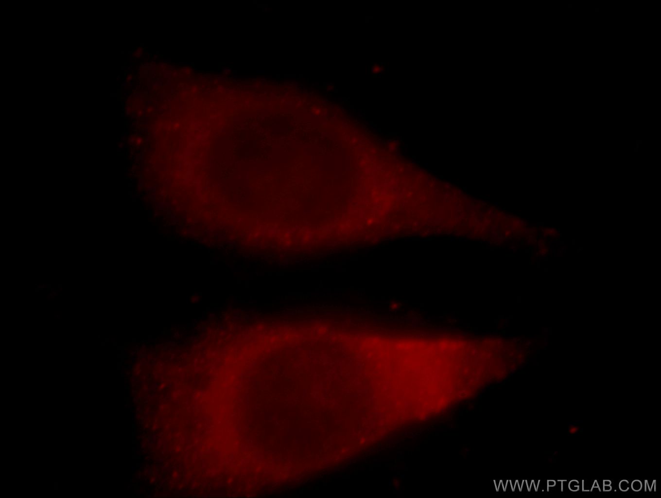 IF Staining of HeLa using 15222-1-AP