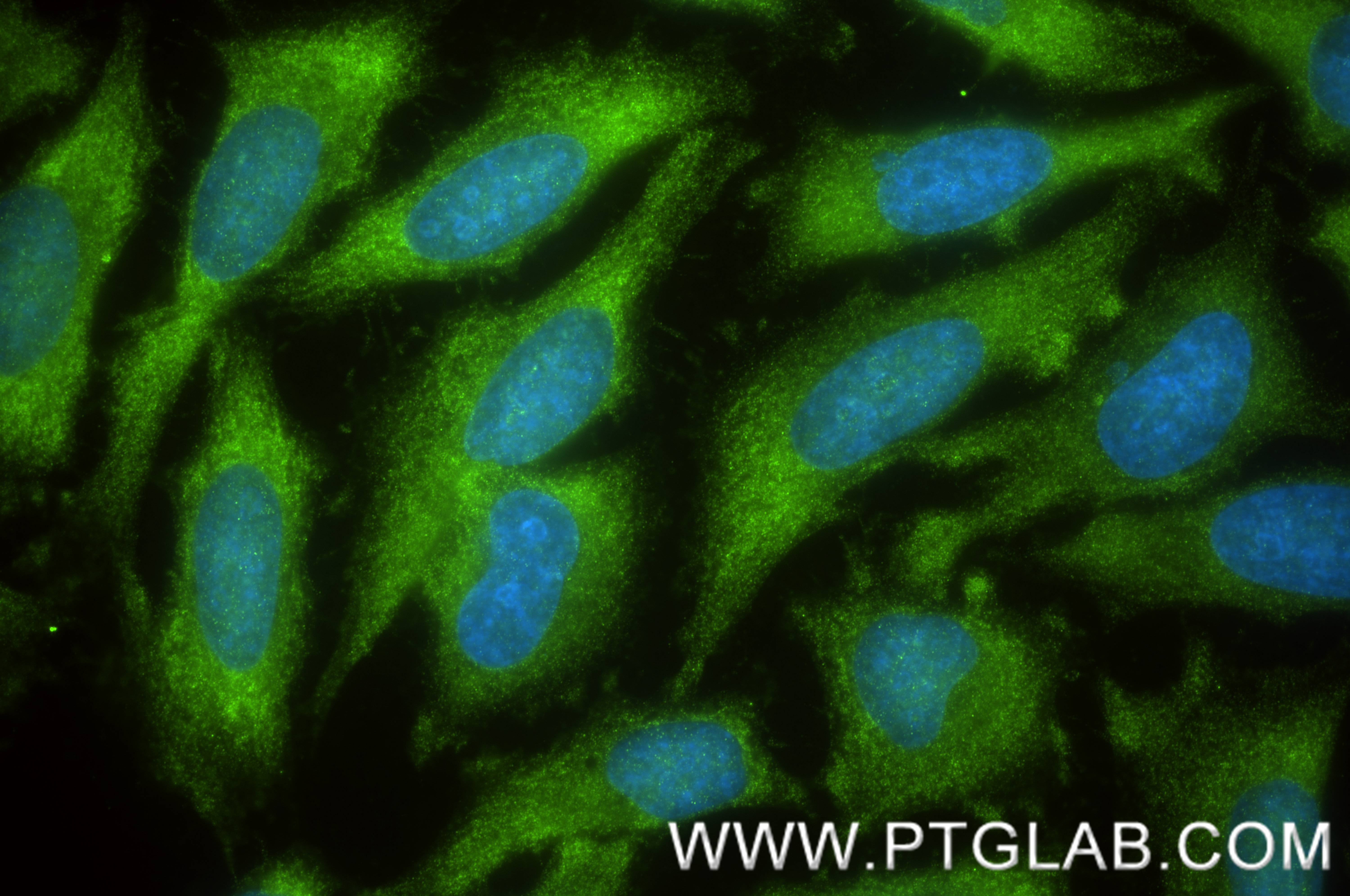 IF Staining of HeLa using 85987-1-RR