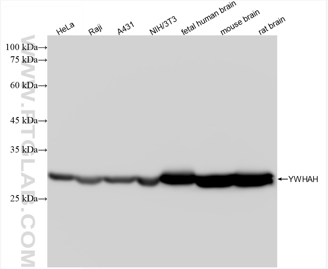 WB analysis using 85987-1-RR (same clone as 85987-1-PBS)