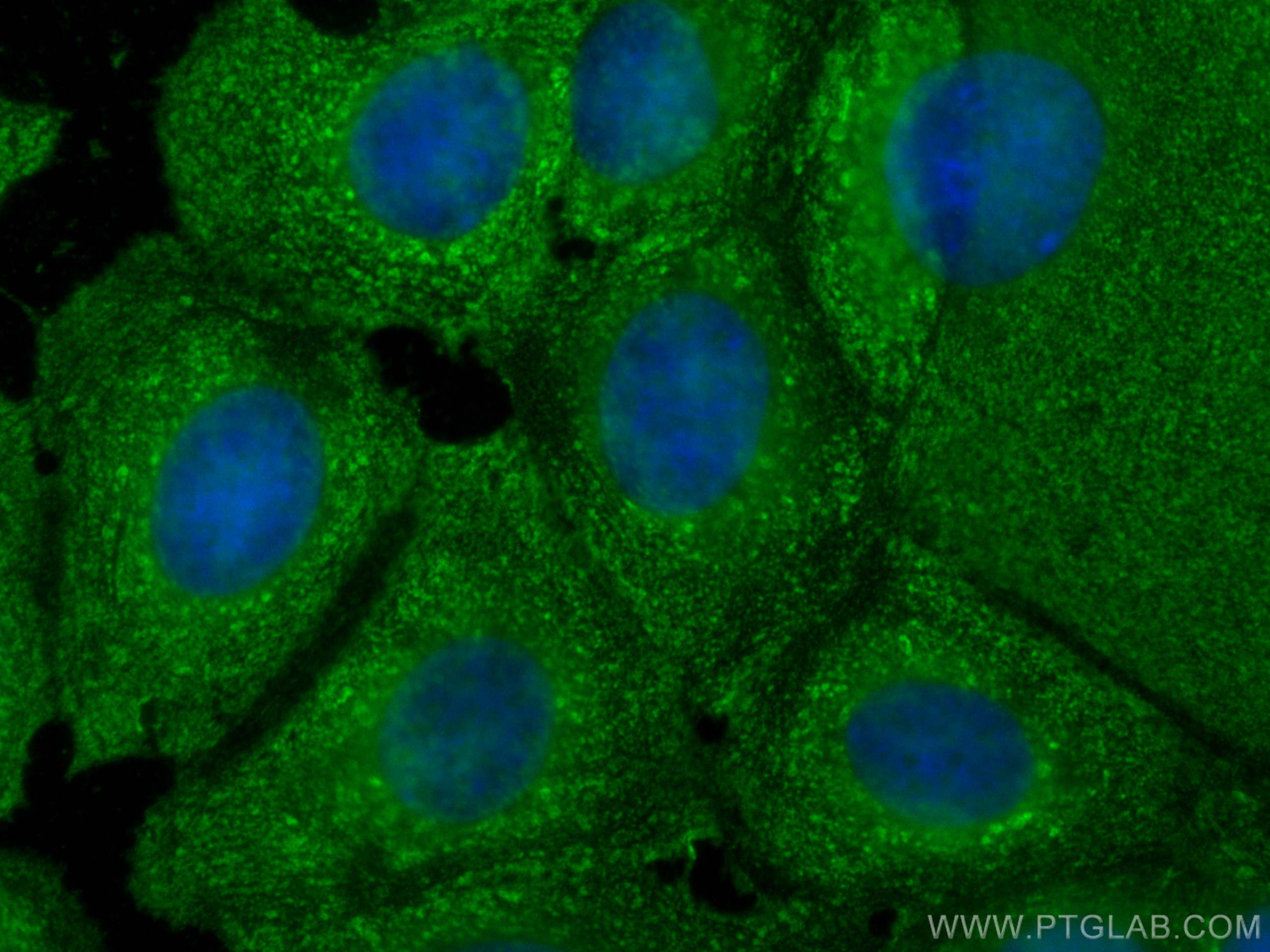 IF Staining of MCF-7 using 67698-1-Ig (same clone as 67698-1-PBS)