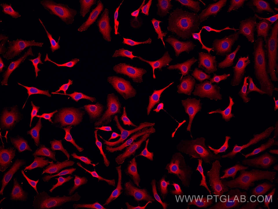 IF Staining of HeLa using 67698-1-Ig (same clone as 67698-1-PBS)