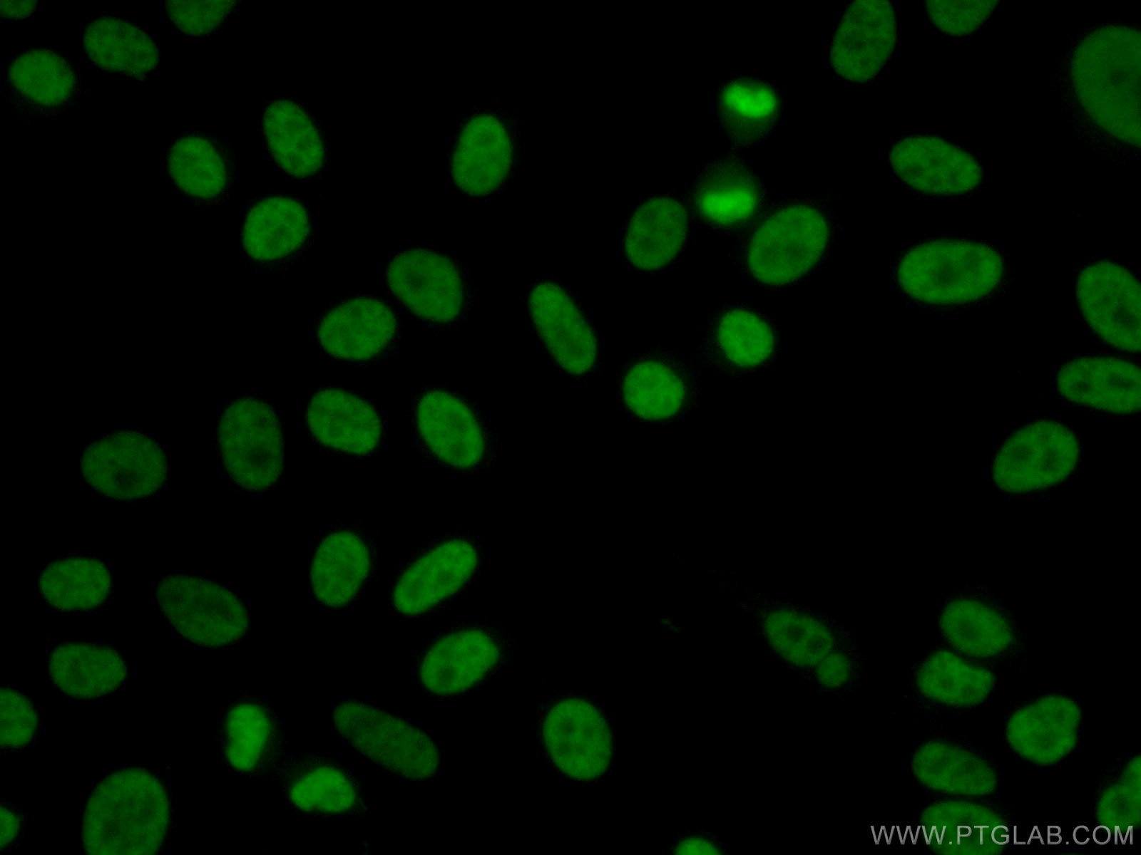 IF Staining of HepG2 using 22156-1-AP