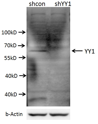 WB analysis of A549 cells using 22156-1-AP