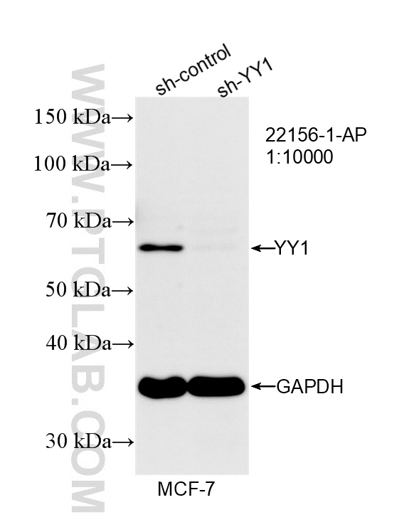 WB analysis of MCF-7 using 22156-1-AP