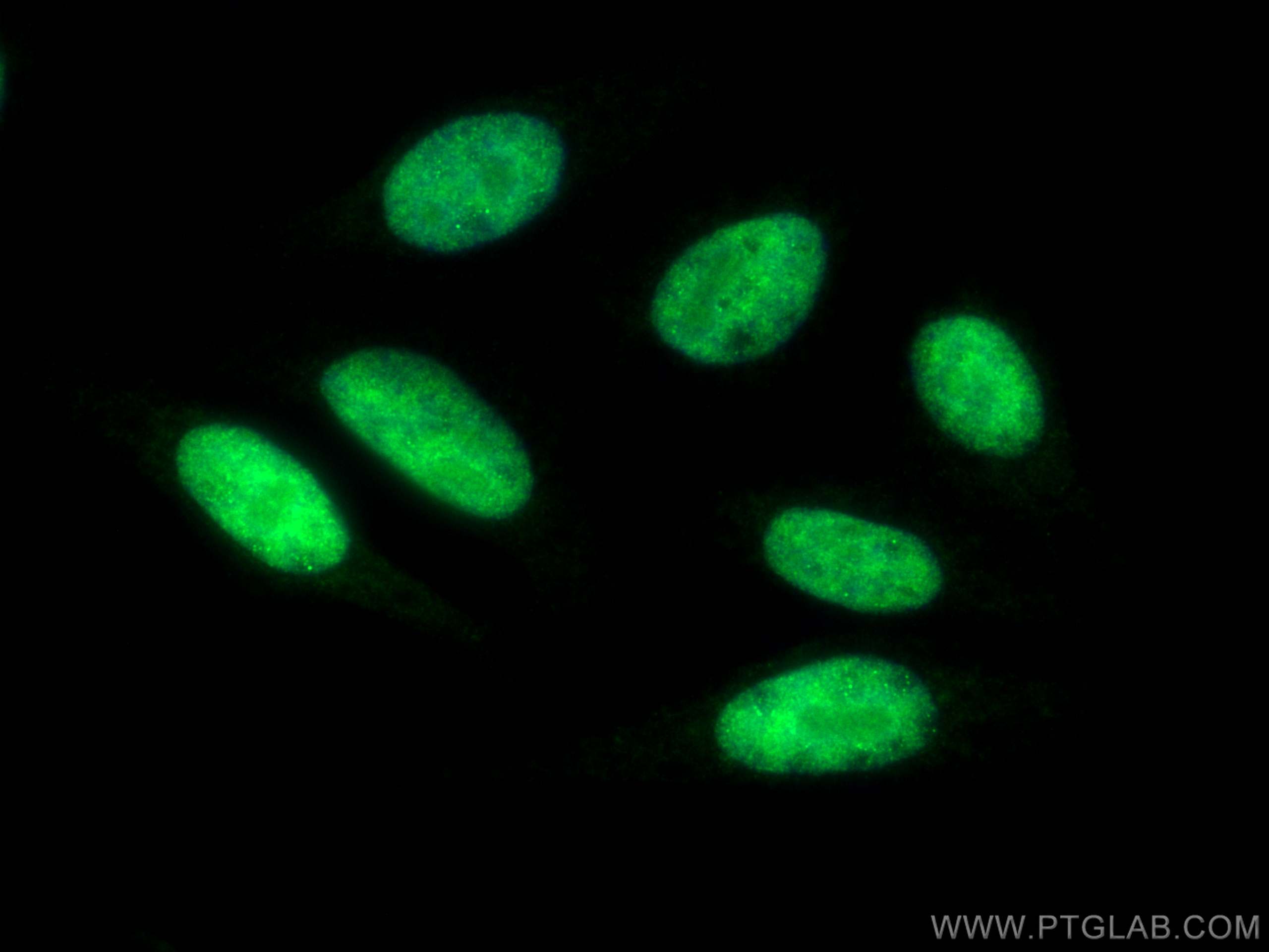 IF Staining of HepG2 using 82712-5-RR