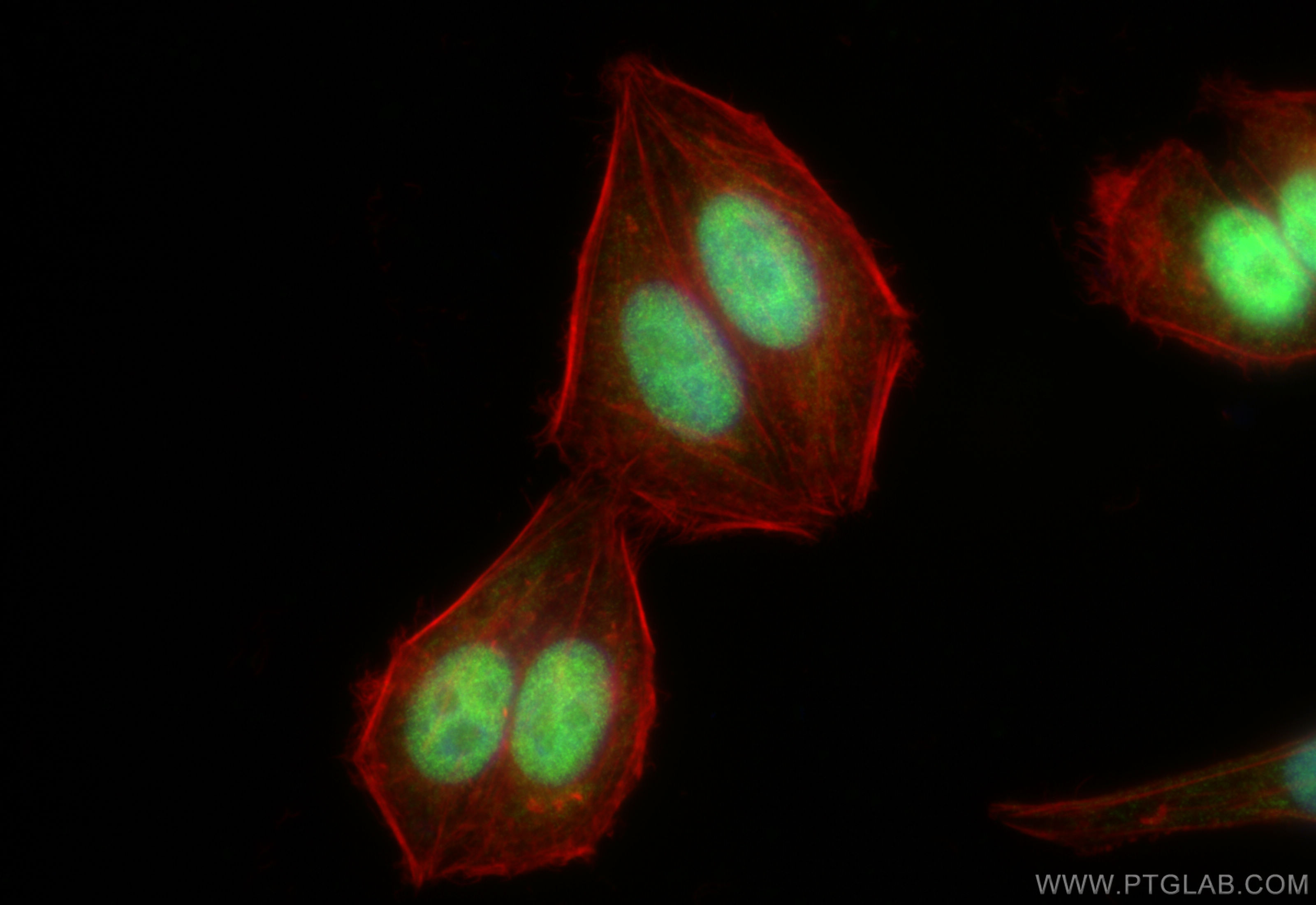 IF Staining of HepG2 using 82712-5-RR