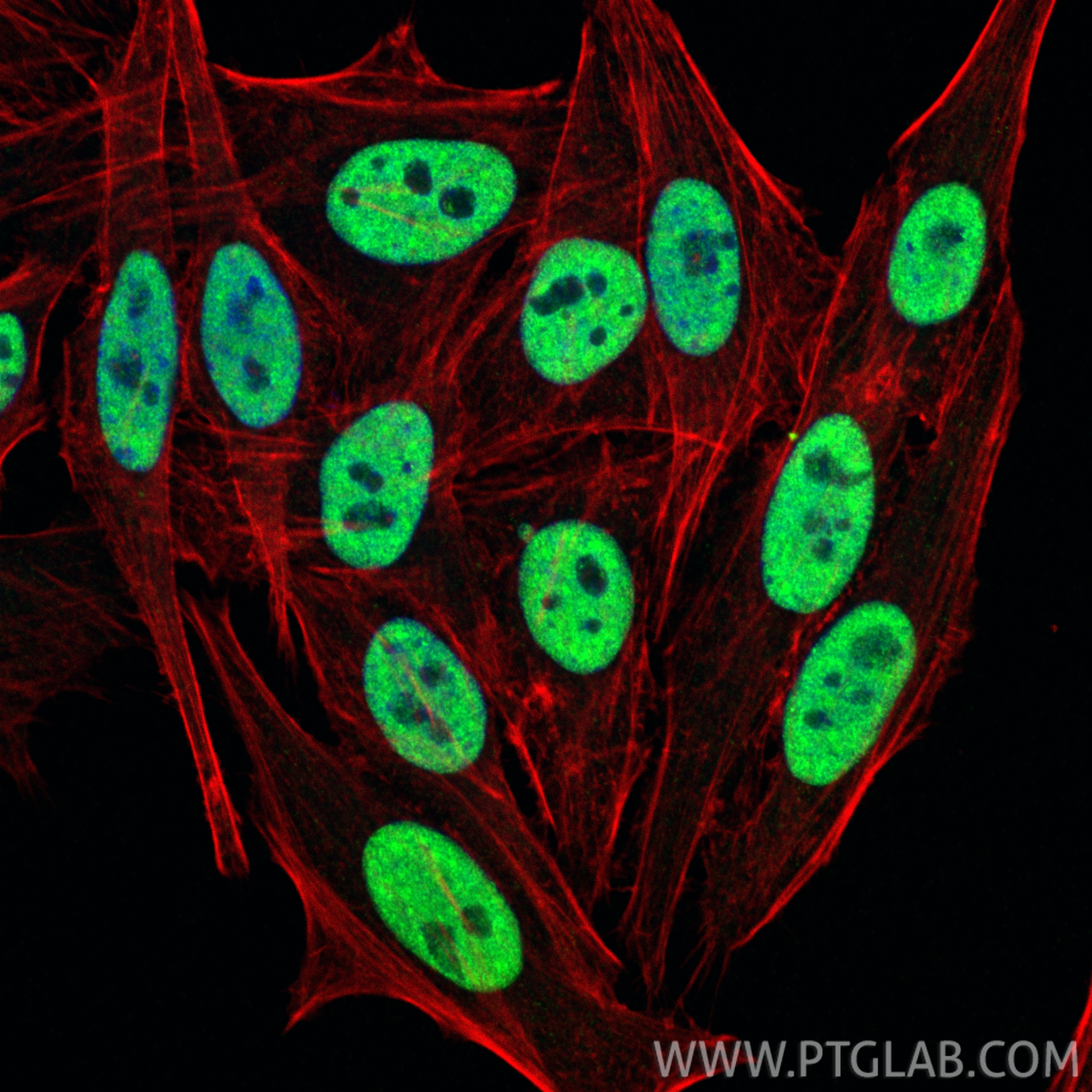 IF Staining of HepG2 using 82712-5-RR IF Staining of HepG2 using 82712-5-RR