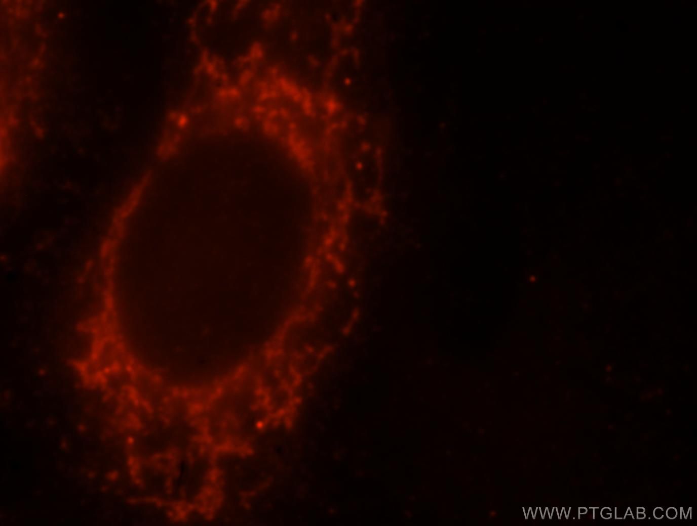 IF Staining of HepG2 using 10425-1-AP