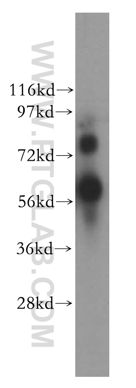 WB analysis of MDA-MB-231 using 10425-1-AP