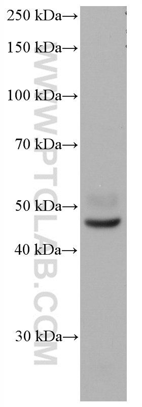 WB analysis of human kidney using 66839-1-Ig (same clone as 66839-1-PBS)