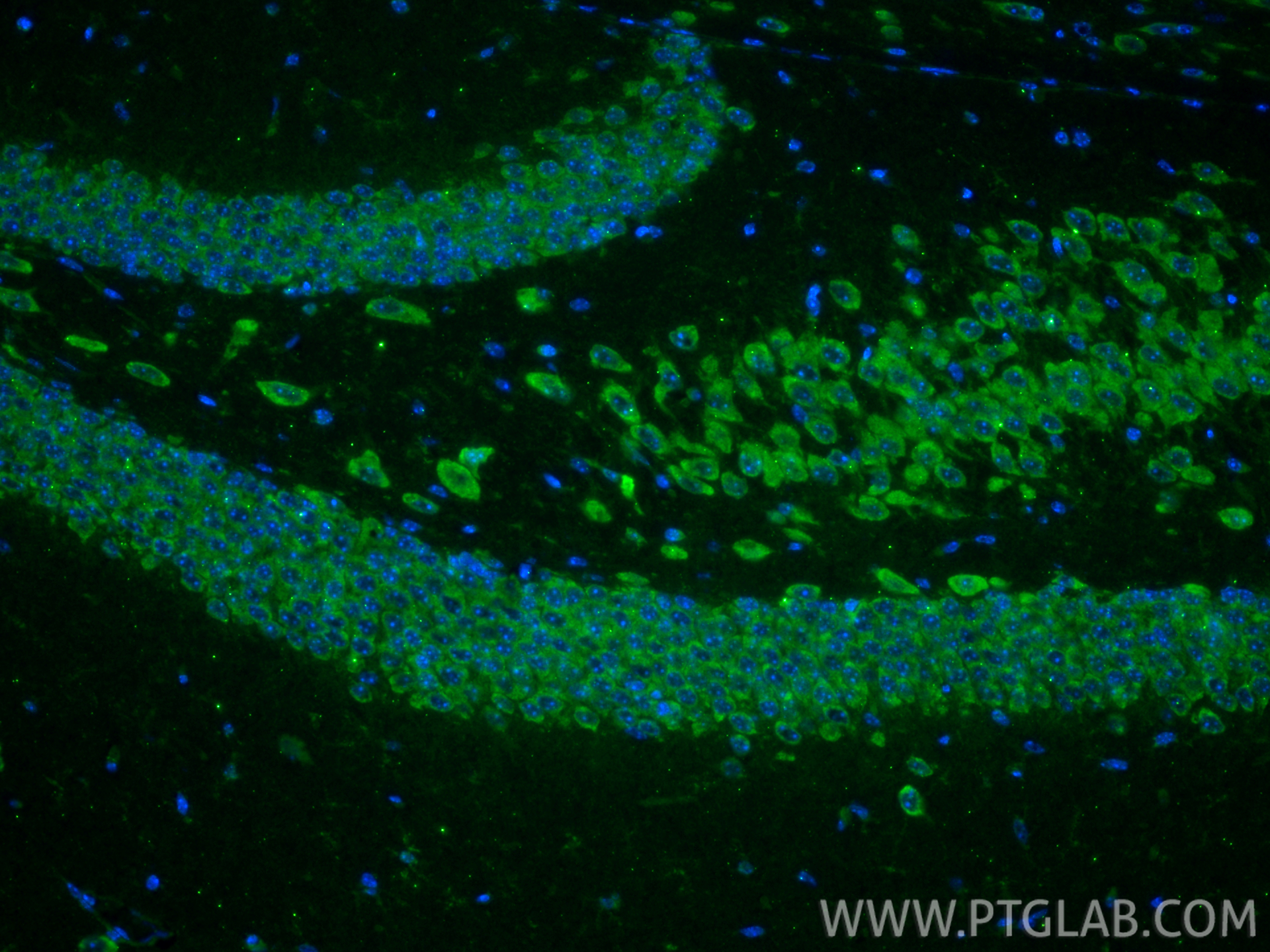 IF Staining of mouse brain using 14679-1-AP IF Staining of mouse brain using 14679-1-AP
