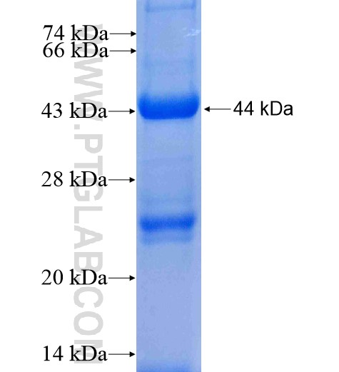 ZADH2 fusion protein Ag7136 SDS-PAGE ZADH2 fusion protein Ag7136 SDS-PAGE