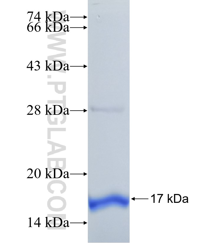 ZAK fusion protein Ag30623 SDS-PAGE ZAK fusion protein Ag30623 SDS-PAGE