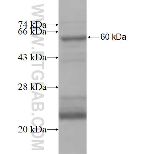 ZAK fusion protein Ag7670 SDS-PAGE ZAK fusion protein Ag7670 SDS-PAGE