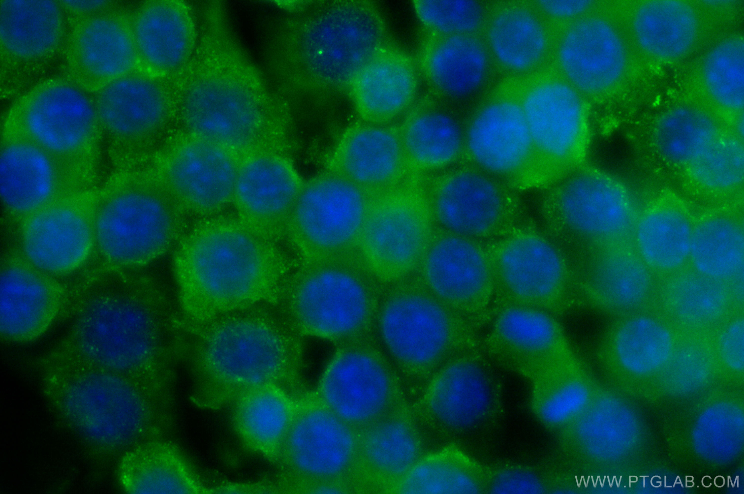 IF Staining of RAW 264.7 using 15592-1-AP