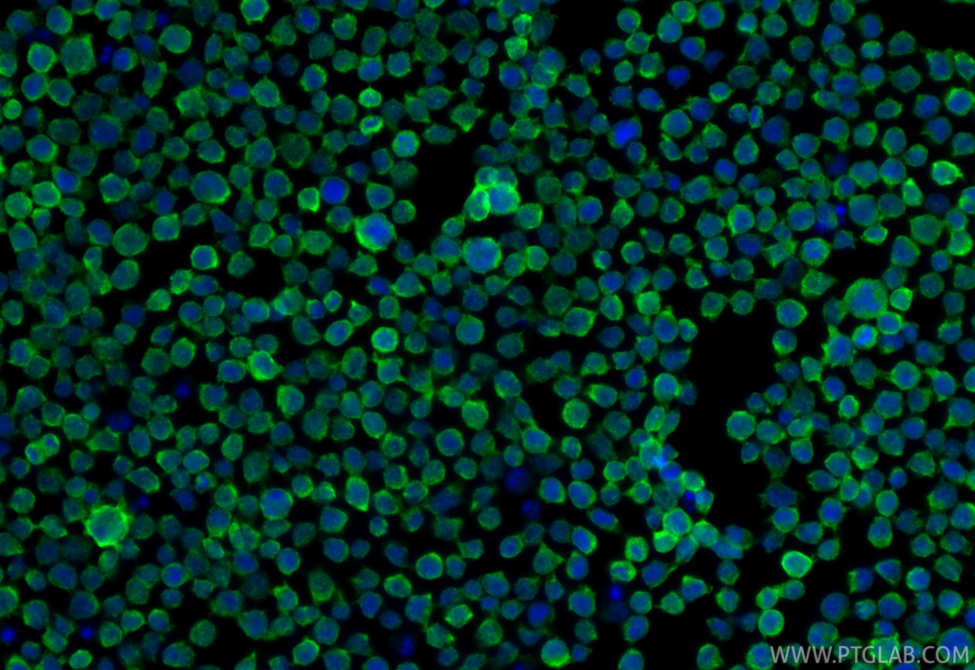 IF Staining of Jurkat using 60200-1-Ig IF Staining of Jurkat using 60200-1-Ig