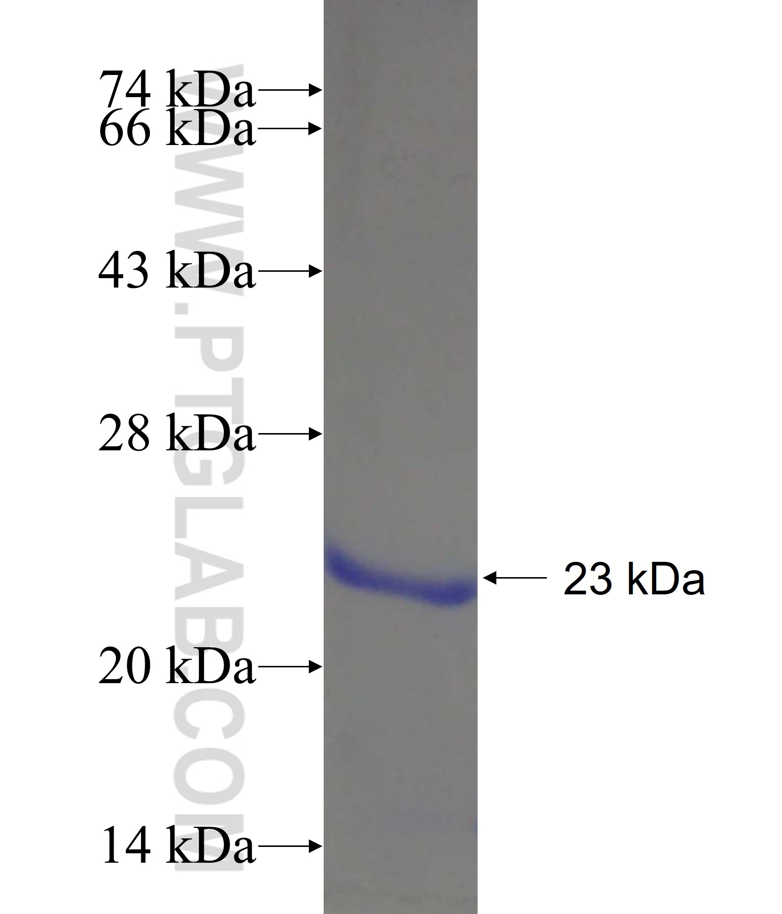 ZAP70 fusion protein Ag17655 SDS-PAGE ZAP70 fusion protein Ag17655 SDS-PAGE