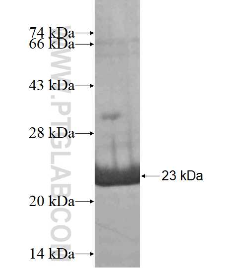 ZAP70 fusion protein Ag17655 SDS-PAGE