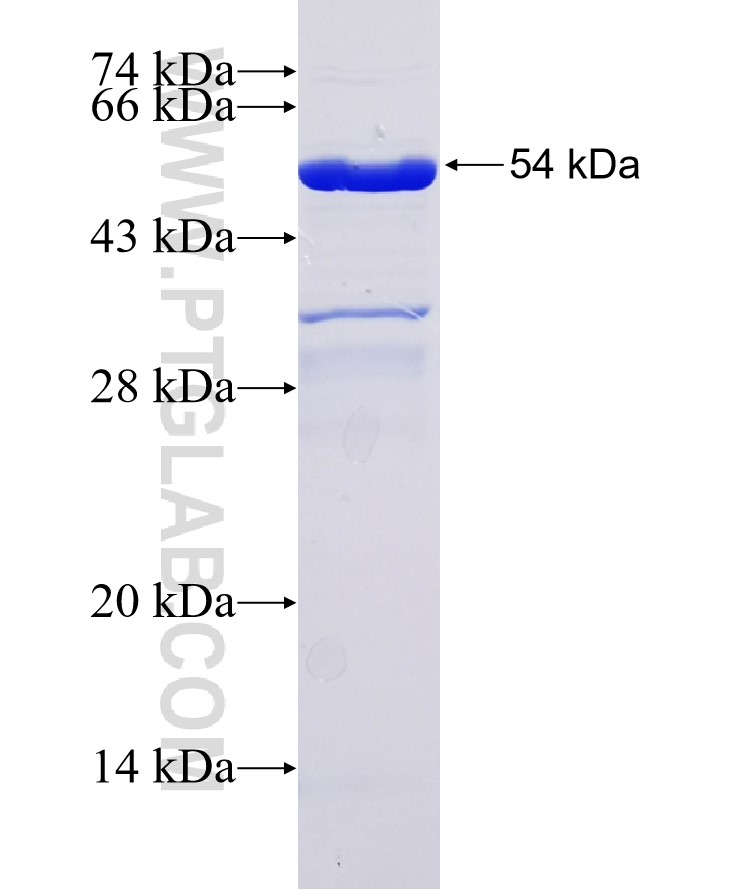 ZAR1 fusion protein Ag34679 SDS-PAGE