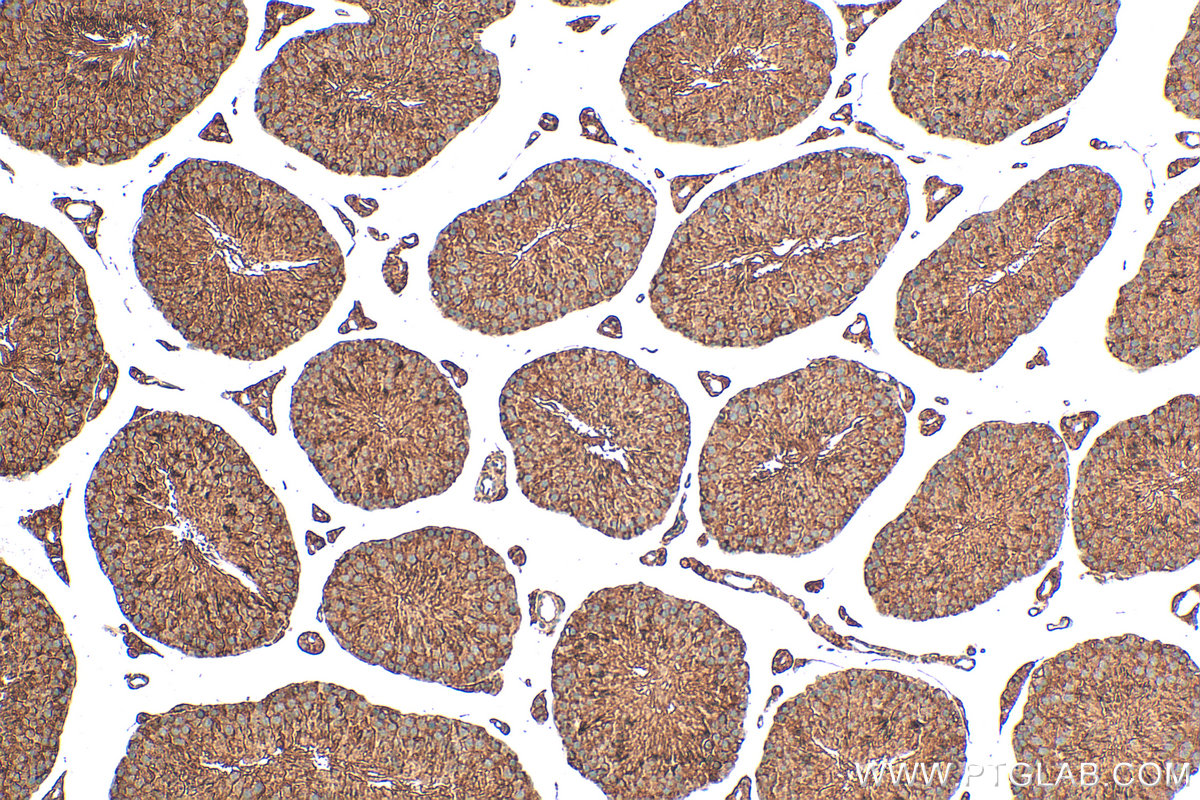 IHC staining of mouse testis using 23958-1-AP IHC staining of mouse testis using 23958-1-AP