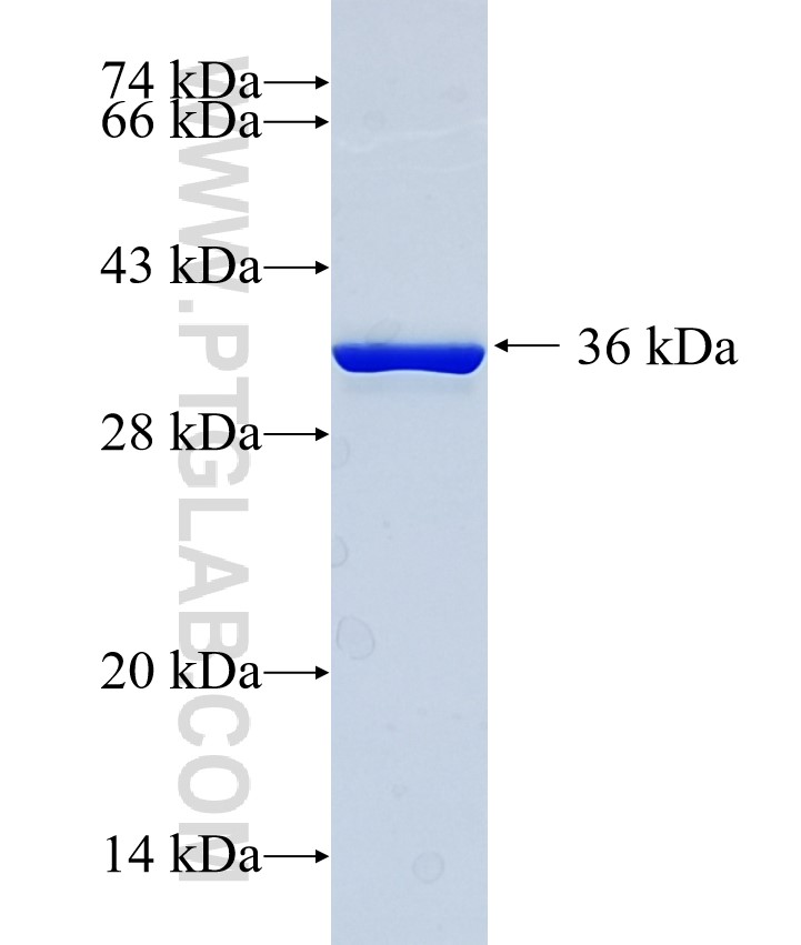 ZBED3 fusion protein Ag35445 SDS-PAGE ZBED3 fusion protein Ag35445 SDS-PAGE