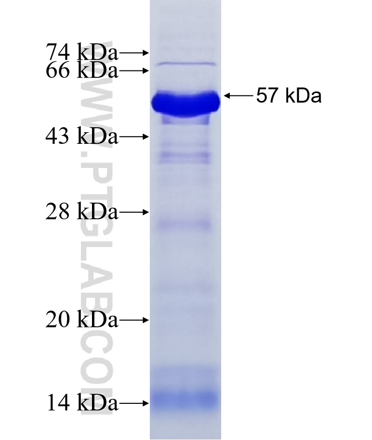ZBED4 fusion protein Ag16518 SDS-PAGE ZBED4 fusion protein Ag16518 SDS-PAGE