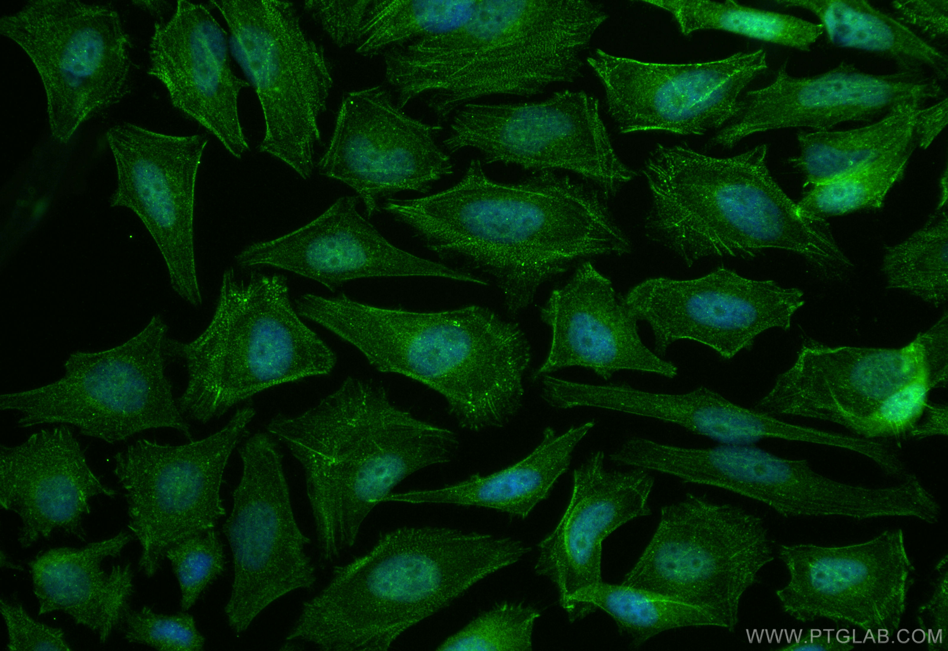 Immunofluorescent analysis of (4% PFA) fixed HeLa cells using ZBP1 antibody (13285-1-AP) at dilution of 1:200 and CoraLite®488-Conjugated Goat Anti-Rabbit IgG(H+L) (<a class='green' href='/productredirect?CatalogNo=SA00013-2' target='_blank'>SA00013-2</a>). IF Staining of HeLa using 13285-1-AP
