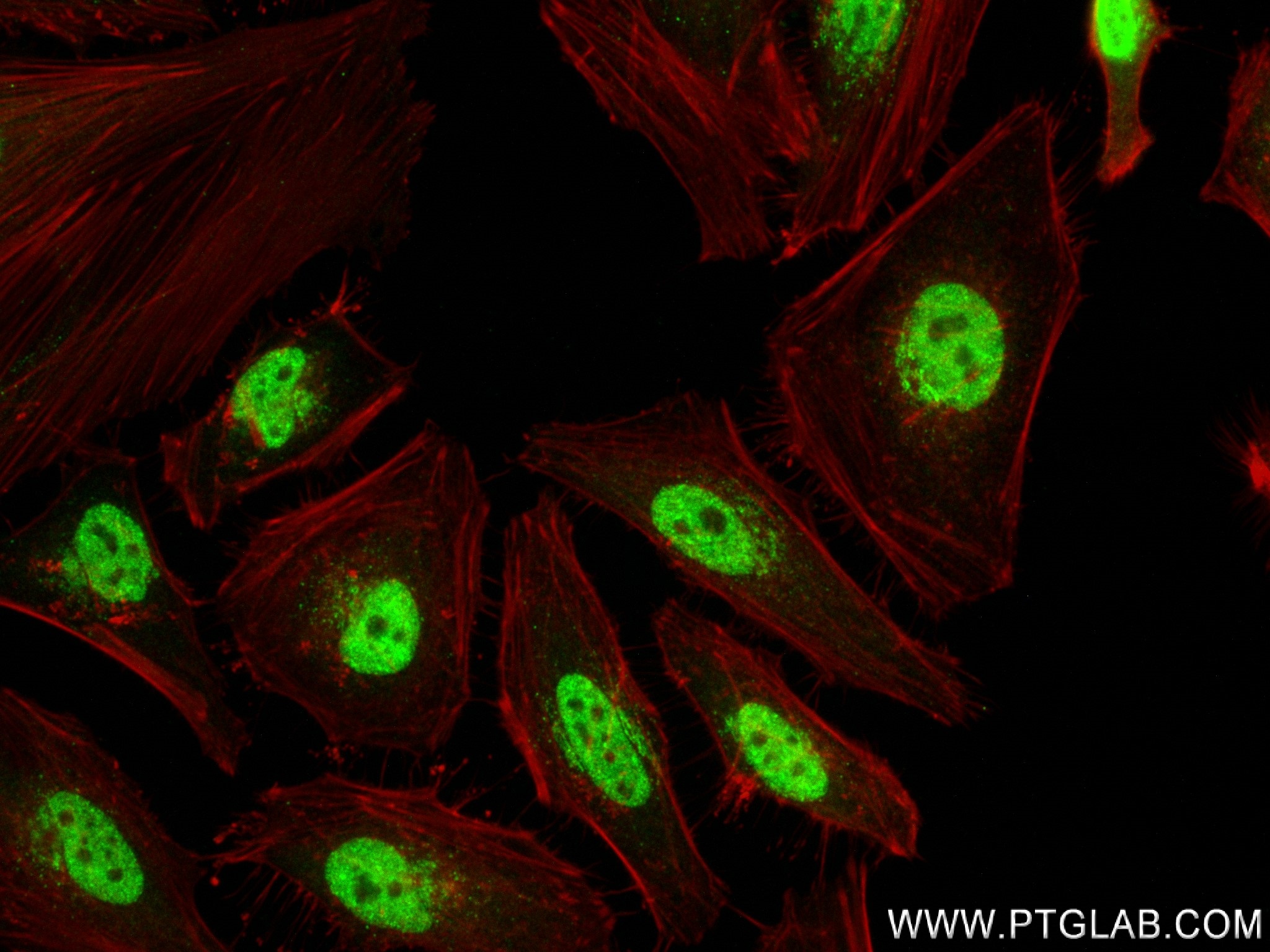 IF Staining of HeLa using 84396-2-RR (same clone as 84396-2-PBS)