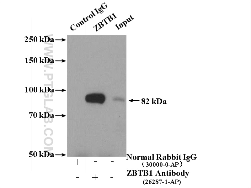 IP experiment of HeLa using 26287-1-AP