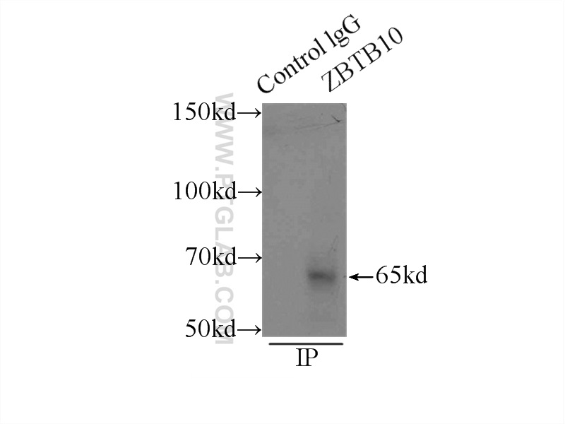 IP experiment of mouse liver using 22944-1-AP