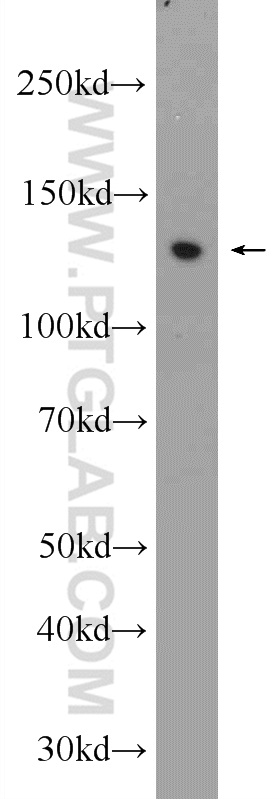 WB analysis of A375 using 22944-1-AP
