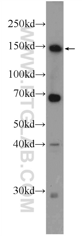 WB analysis of mouse liver using 25215-1-AP (same clone as 25215-1-PBS)