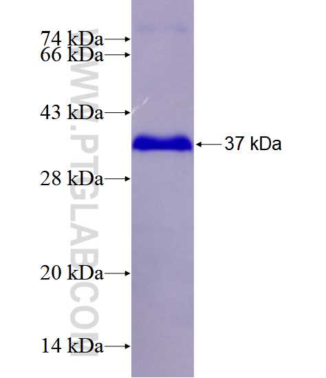 ZBTB16 fusion protein Ag28511 SDS-PAGE