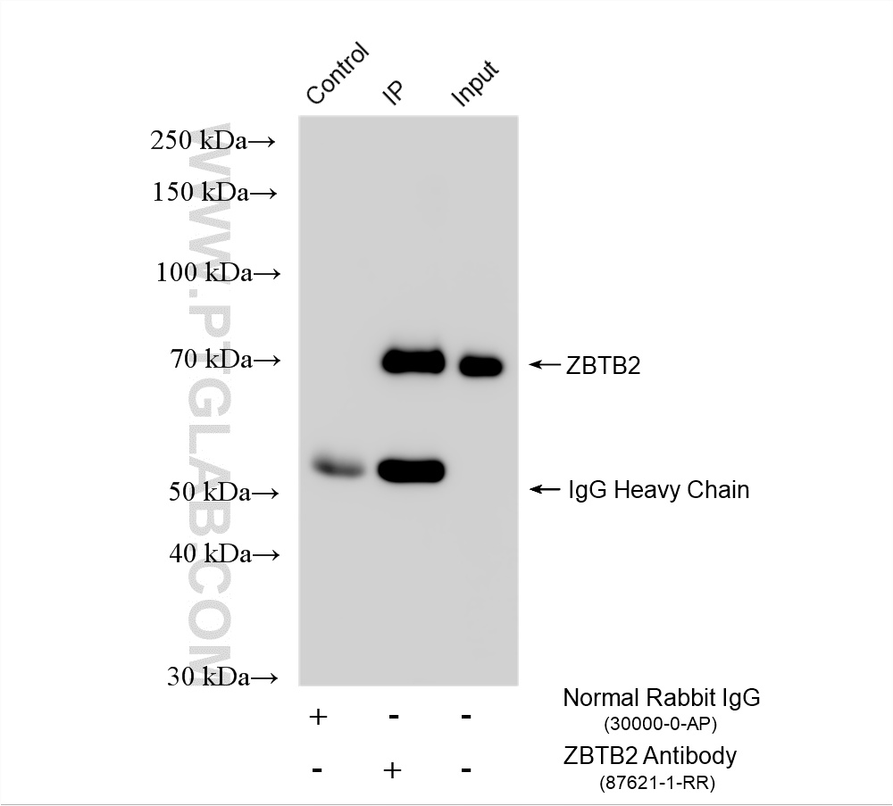 IP experiment of HEK-293T using 87621-1-RR IP experiment of HEK-293T using 87621-1-RR